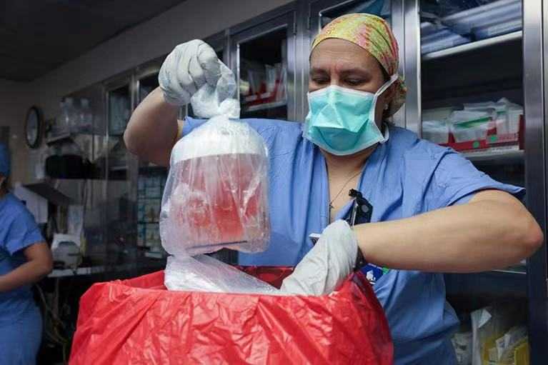 US Surgeons Complete World's First Living Human Pig Kidney Transplant